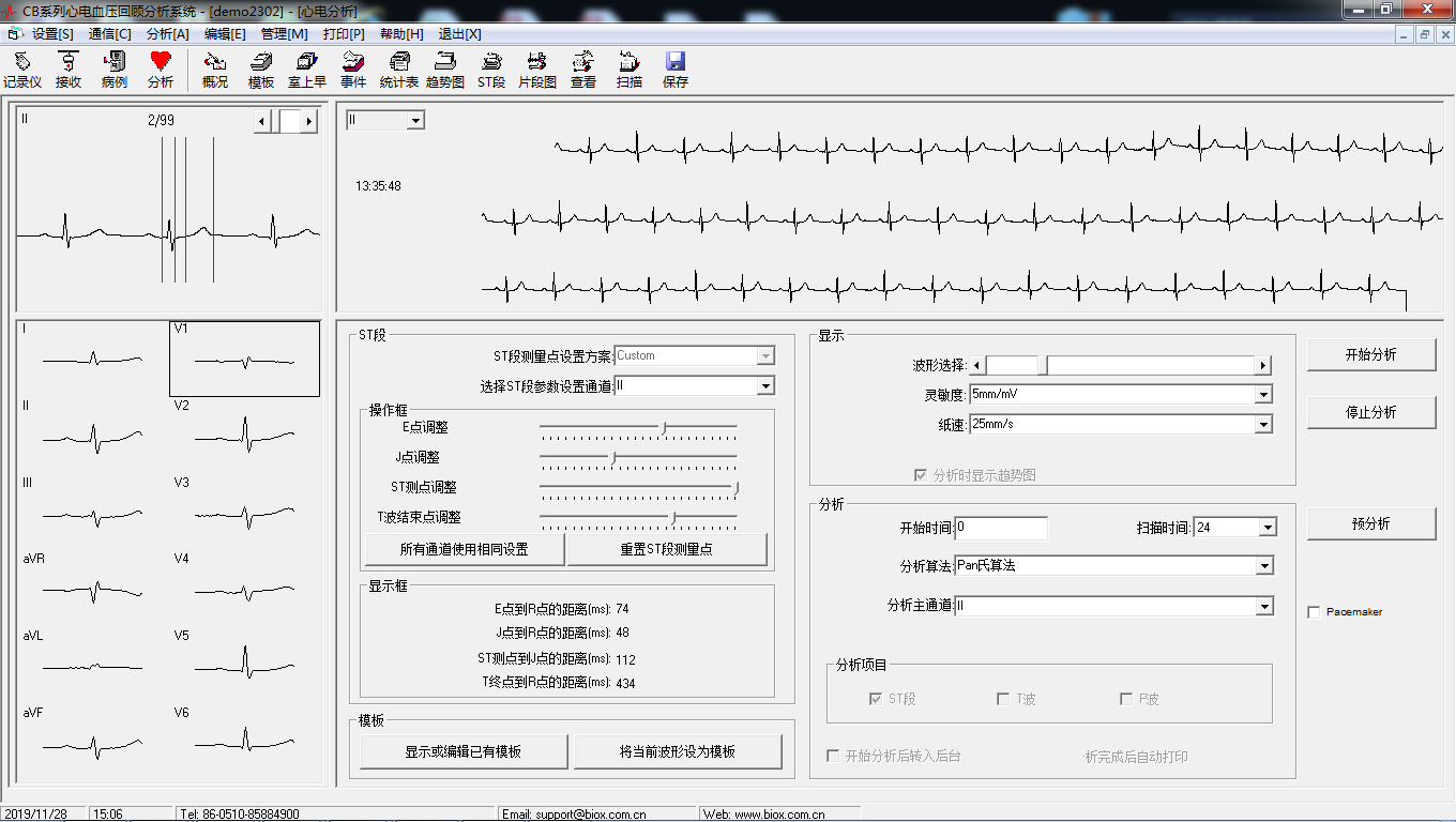 CB系列心電血壓回顧分析系統經典版